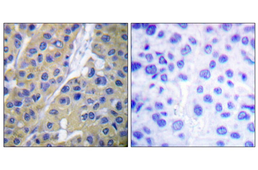 Immunohistochemistry - Anti-Keratin 18 (phospho Ser33) Antibody (A0016) - Antibodies.com