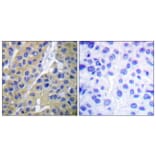 Immunohistochemistry - Anti-Keratin 18 (phospho Ser33) Antibody (A0016) - Antibodies.com