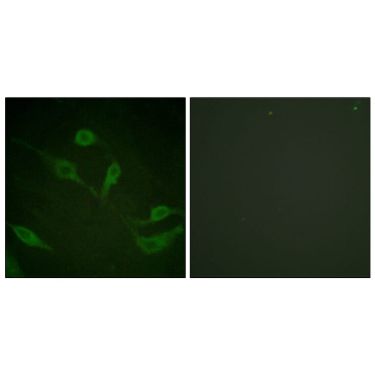 Immunofluorescence - Anti-Keratin 18 (phospho Ser33) Antibody (A0016) - Antibodies.com