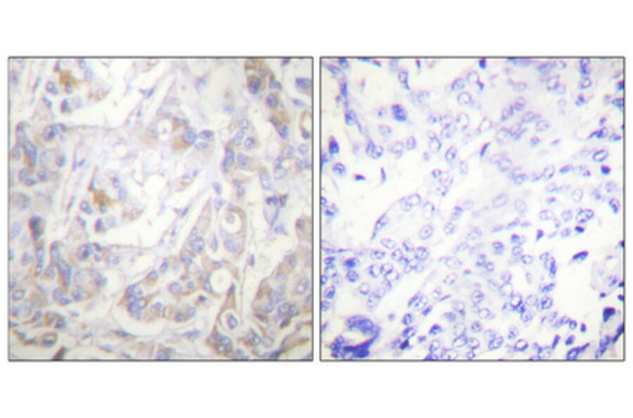 Immunohistochemistry - Anti-Keratin 18 (phospho Ser33) Antibody (A0016) - Antibodies.com