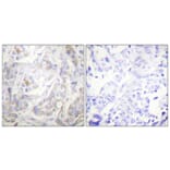 Immunohistochemistry - Anti-Keratin 18 (phospho Ser33) Antibody (A0016) - Antibodies.com