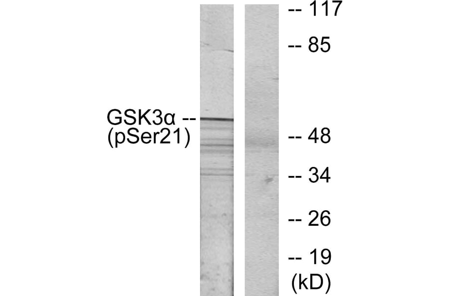 Western Blot - Anti-GSK3 alpha (phospho Ser21) Antibody (A7097) - Antibodies.com