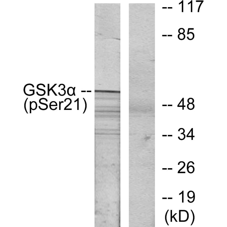 Western Blot - Anti-GSK3 alpha (phospho Ser21) Antibody (A7097) - Antibodies.com