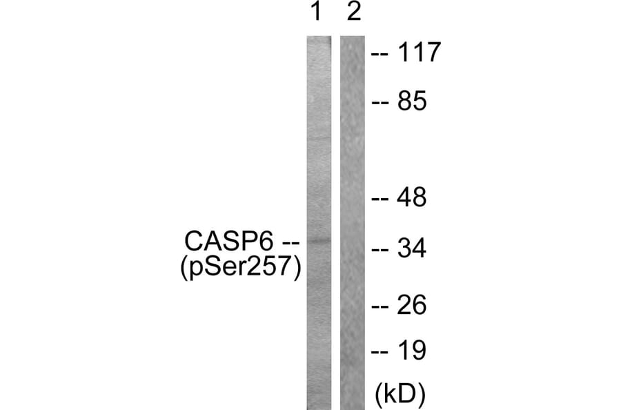 Western Blot - Anti-Caspase 6 (phospho Ser257) Antibody (A0058) - Antibodies.com