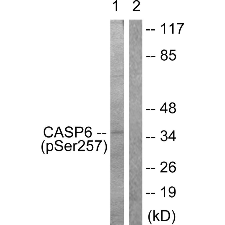 Western Blot - Anti-Caspase 6 (phospho Ser257) Antibody (A0058) - Antibodies.com