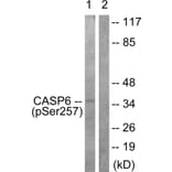 Western Blot - Anti-Caspase 6 (phospho Ser257) Antibody (A0058) - Antibodies.com