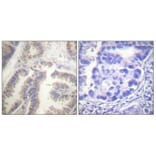 Immunohistochemistry - Anti-Caspase 6 (phospho Ser257) Antibody (A0058) - Antibodies.com