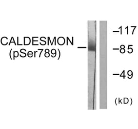 Western Blot - Anti-Caldesmon (phospho Ser789) Antibody (A0462) - Antibodies.com