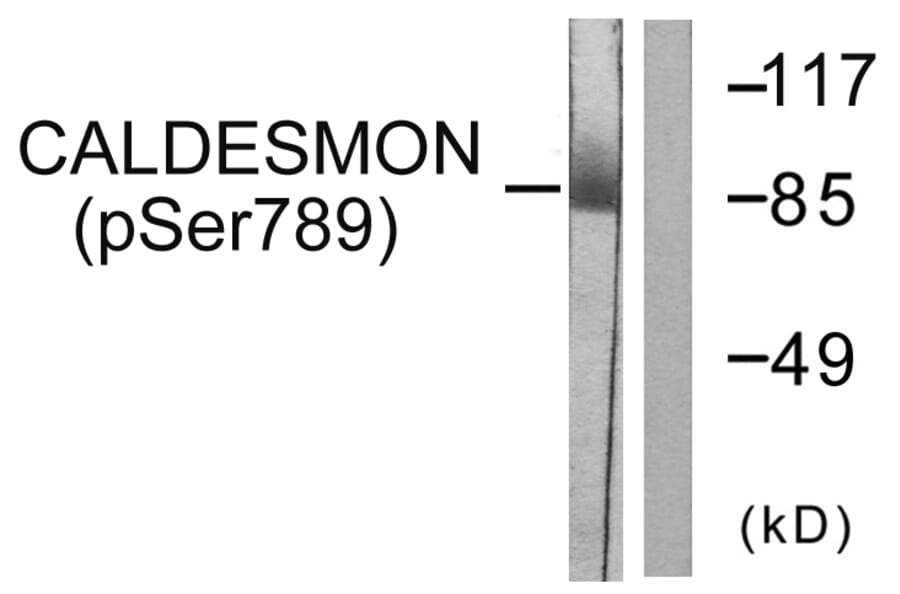 Western Blot - Anti-Caldesmon (phospho Ser789) Antibody (A0462) - Antibodies.com