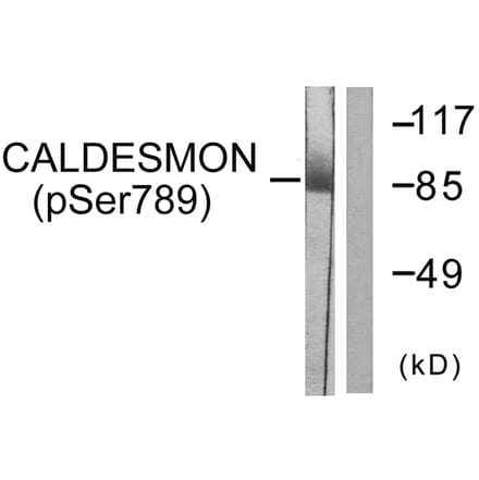 Western Blot - Anti-Caldesmon (phospho Ser789) Antibody (A0462) - Antibodies.com