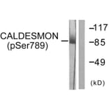 Western Blot - Anti-Caldesmon (phospho Ser789) Antibody (A0462) - Antibodies.com