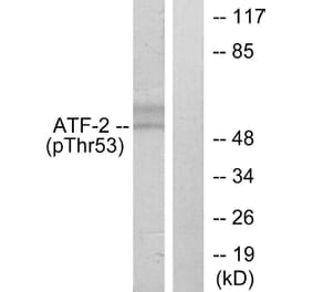 Western Blot - Anti-ATF2 (phospho Thr71 or 53) Antibody (A7015) - Antibodies.com