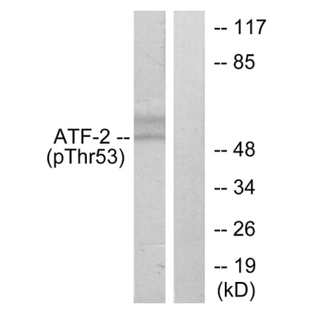 Western Blot - Anti-ATF2 (phospho Thr71 or 53) Antibody (A7015) - Antibodies.com