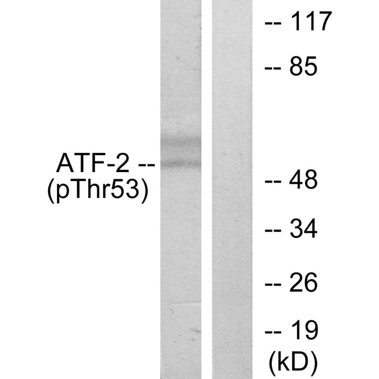 Western Blot - Anti-ATF2 (phospho Thr71 or 53) Antibody (A7015) - Antibodies.com