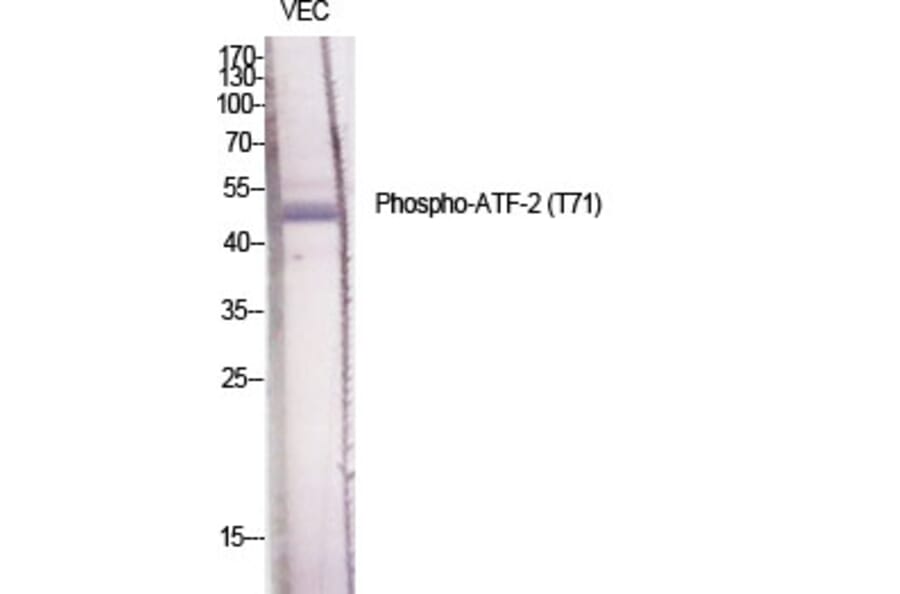 Western Blot - Anti-ATF2 (phospho Thr71 or 53) Antibody (A7015) - Antibodies.com