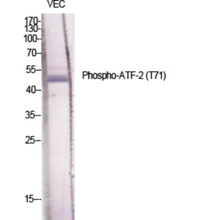 Western Blot - Anti-ATF2 (phospho Thr71 or 53) Antibody (A7015) - Antibodies.com