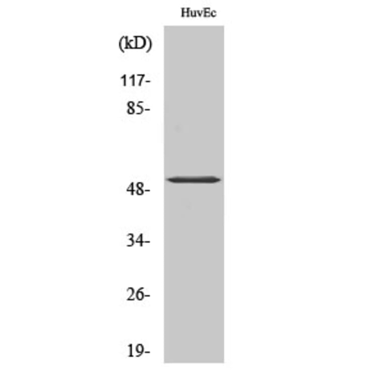 Western Blot - Anti-ATF2 (phospho Thr71 or 53) Antibody (A7015) - Antibodies.com