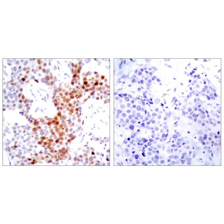 Immunohistochemistry - Anti-ATF2 (phospho Thr69 or 51) Antibody (A7014) - Antibodies.com