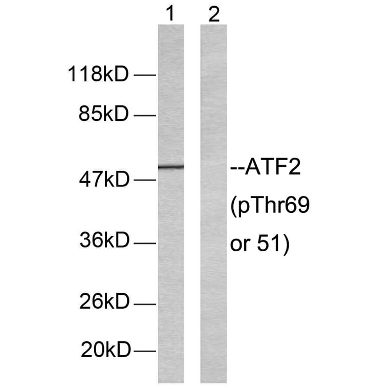 Western Blot - Anti-ATF2 (phospho Thr69 or 51) Antibody (A7014) - Antibodies.com