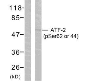 Western Blot - Anti-ATF2 (phospho Ser62 or 44) Antibody (A7013) - Antibodies.com