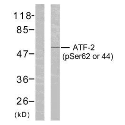 Western Blot - Anti-ATF2 (phospho Ser62 or 44) Antibody (A7013) - Antibodies.com