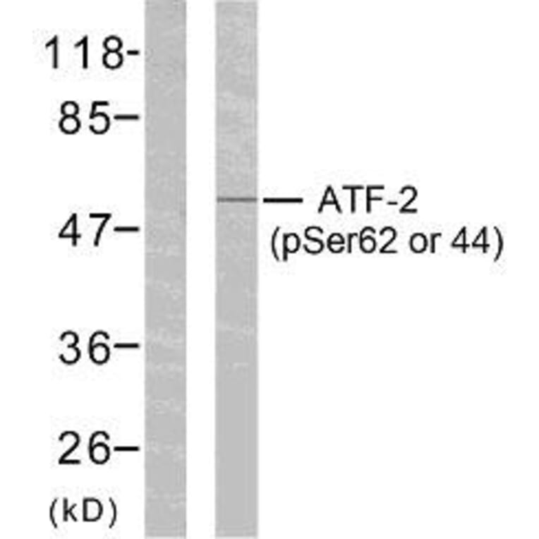 Western Blot - Anti-ATF2 (phospho Ser62 or 44) Antibody (A7013) - Antibodies.com