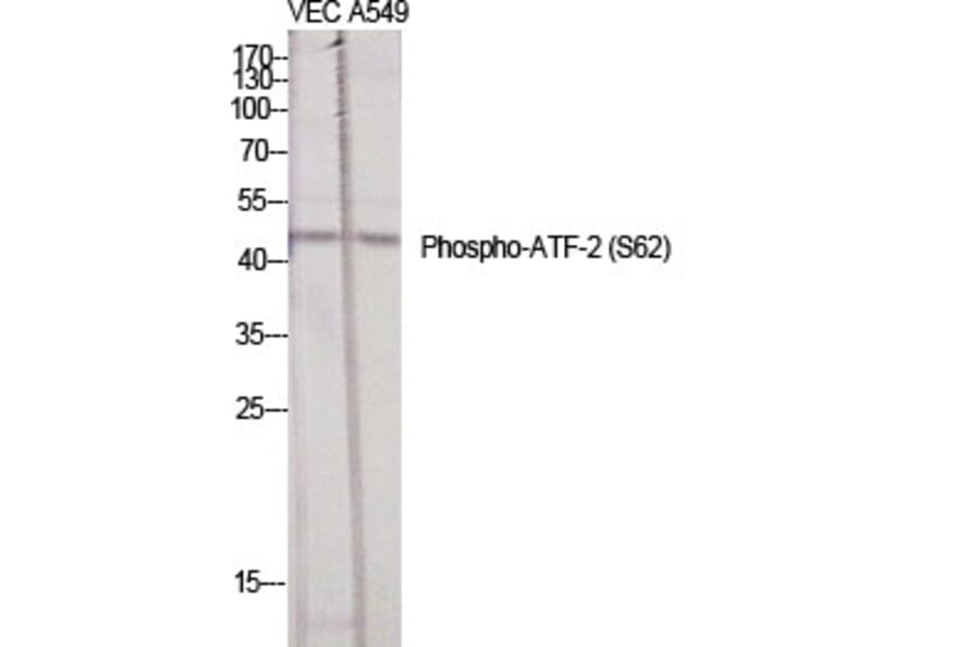 Western Blot - Anti-ATF2 (phospho Ser62 or 44) Antibody (A7013) - Antibodies.com
