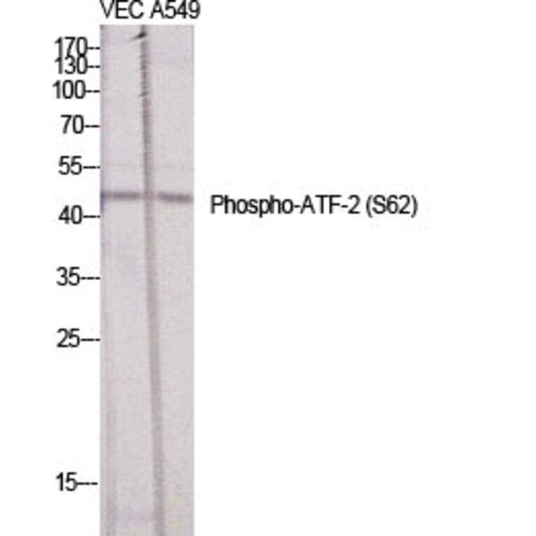 Western Blot - Anti-ATF2 (phospho Ser62 or 44) Antibody (A7013) - Antibodies.com