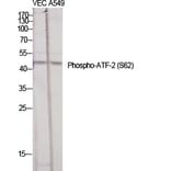 Western Blot - Anti-ATF2 (phospho Ser62 or 44) Antibody (A7013) - Antibodies.com