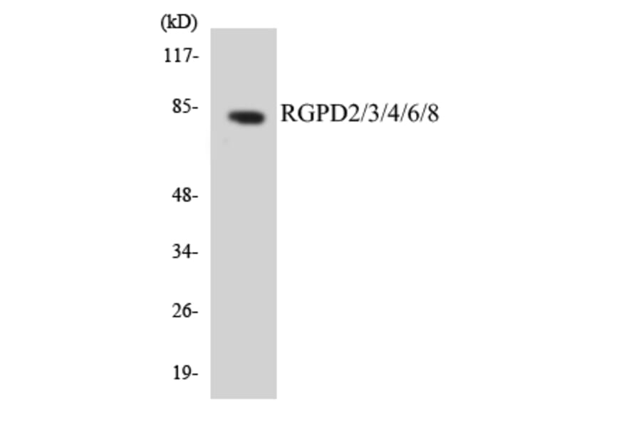 Western Blot - Anti-RGPD2 + RGPD3 + RGPD4 + RGPD6 + RGPD8 Antibody (R12-3431) - Antibodies.com