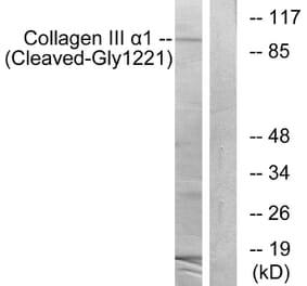Western Blot - Anti-Collagen III alpha1 (cleaved Gly1221) Antibody (L0211) - Antibodies.com