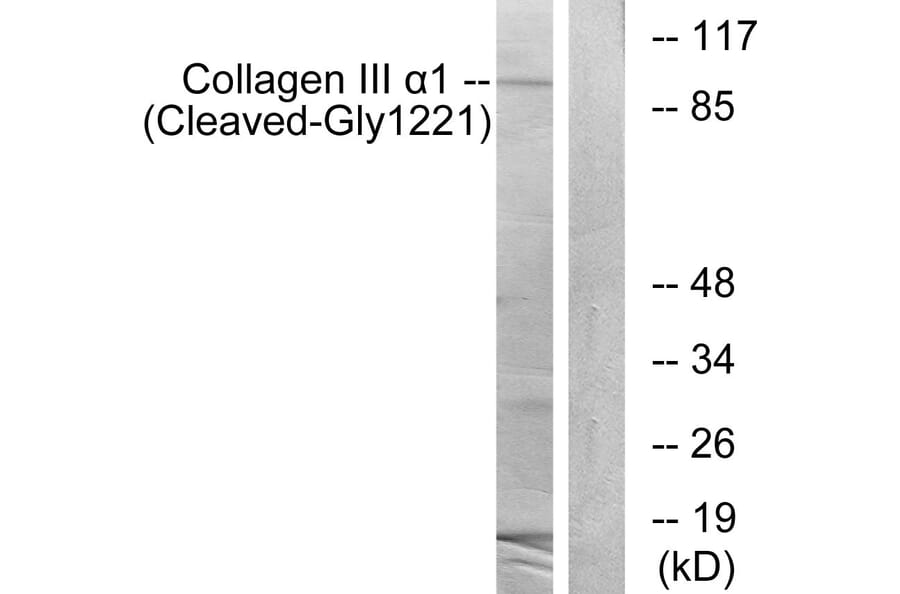 Western Blot - Anti-Collagen III alpha1 (cleaved Gly1221) Antibody (L0211) - Antibodies.com