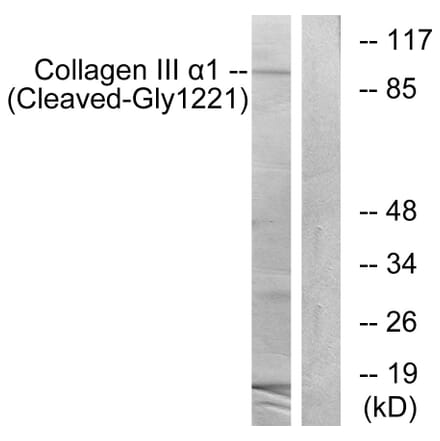 Western Blot - Anti-Collagen III alpha1 (cleaved Gly1221) Antibody (L0211) - Antibodies.com