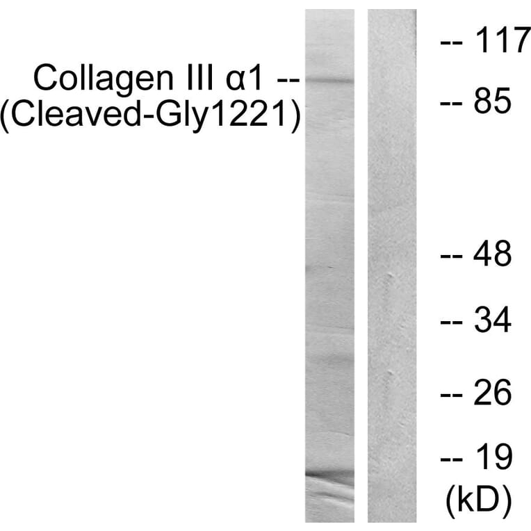 Western Blot - Anti-Collagen III alpha1 (cleaved Gly1221) Antibody (L0211) - Antibodies.com