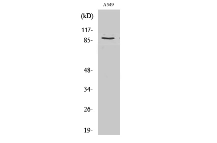 Western Blot - Anti-Collagen III alpha1 (cleaved Gly1221) Antibody (L0211) - Antibodies.com