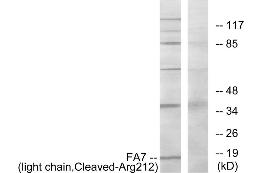 Western Blot - Anti-FA7 (light chain,cleaved Arg212) Antibody (L0259) - Antibodies.com