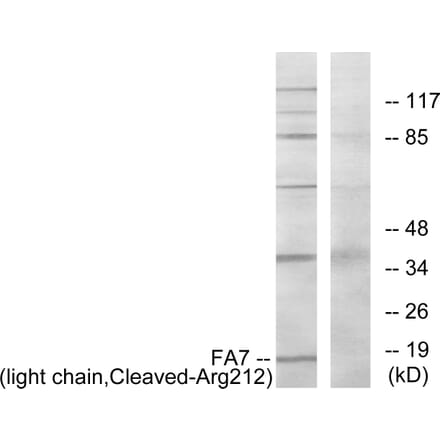 Western Blot - Anti-FA7 (light chain,cleaved Arg212) Antibody (L0259) - Antibodies.com