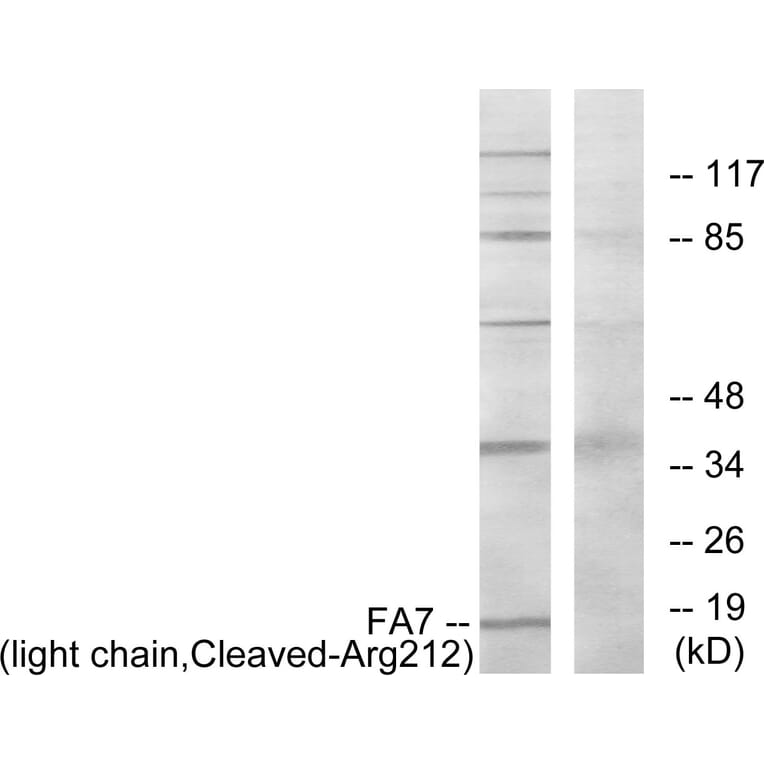 Western Blot - Anti-FA7 (light chain,cleaved Arg212) Antibody (L0259) - Antibodies.com