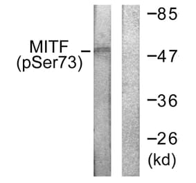 Western Blot - Anti-MITF (phospho Ser180 + Ser73) Antibody (A0512) - Antibodies.com
