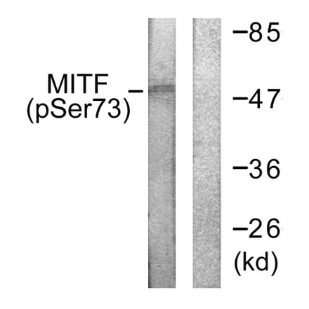 Western Blot - Anti-MITF (phospho Ser180 + Ser73) Antibody (A0512) - Antibodies.com