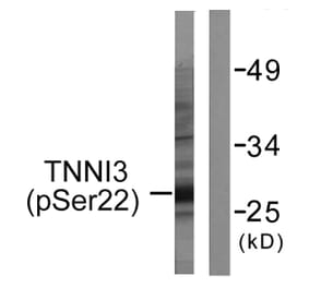 Western Blot - Anti-TNNI3 (phospho Ser22+Ser23) Antibody (A0587) - Antibodies.com