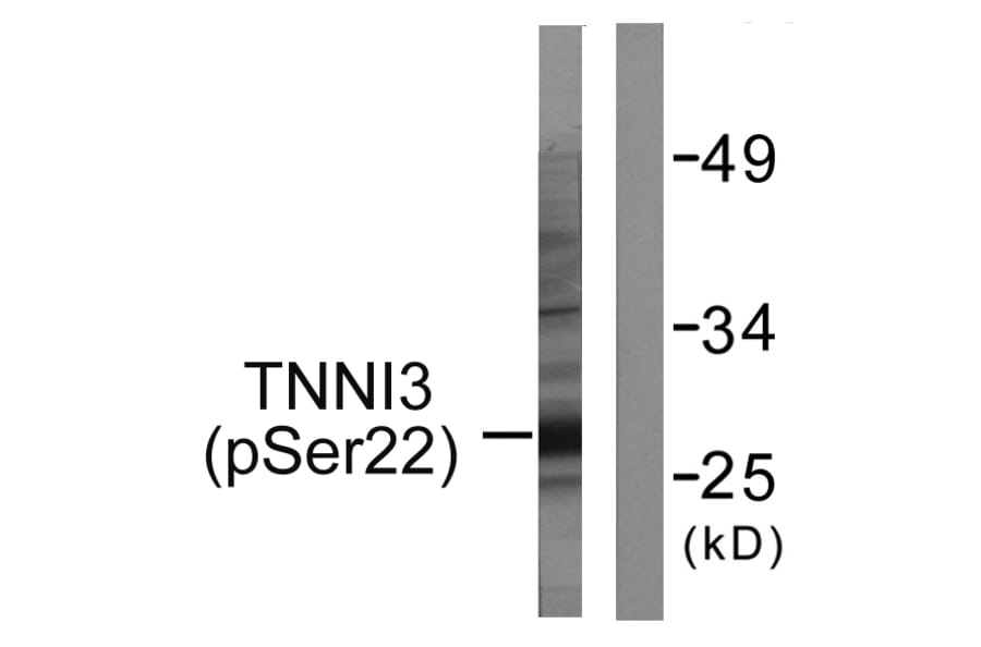 Western Blot - Anti-TNNI3 (phospho Ser22+Ser23) Antibody (A0587) - Antibodies.com