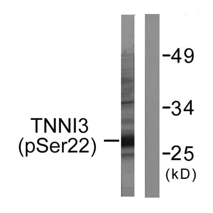 Western Blot - Anti-TNNI3 (phospho Ser22+Ser23) Antibody (A0587) - Antibodies.com