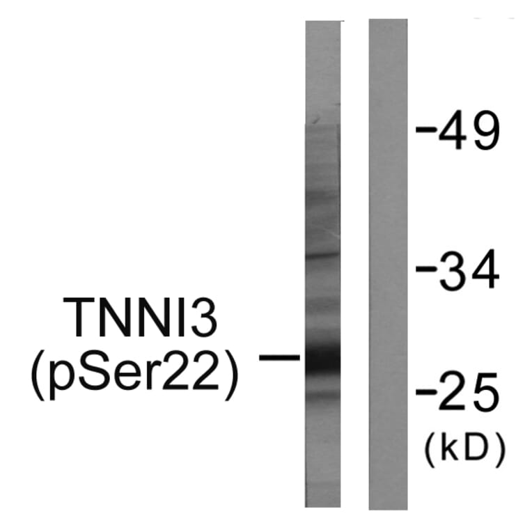 Western Blot - Anti-TNNI3 (phospho Ser22+Ser23) Antibody (A0587) - Antibodies.com