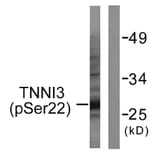 Western Blot - Anti-TNNI3 (phospho Ser22+Ser23) Antibody (A0587) - Antibodies.com