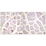 Immunohistochemistry - Anti-TNNI3 (phospho Ser22+Ser23) Antibody (A0587) - Antibodies.com