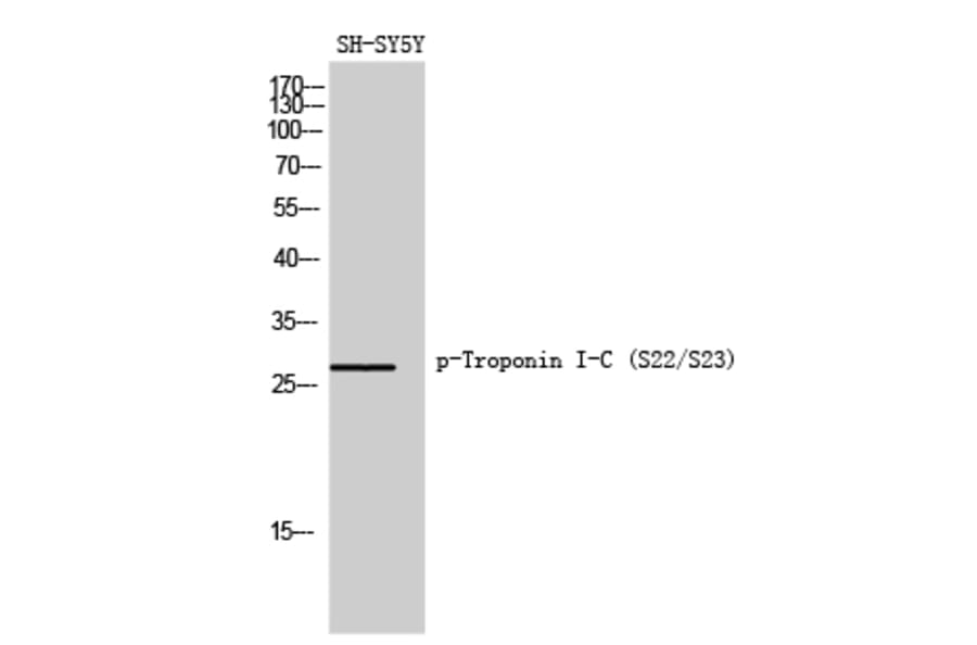 Western Blot - Anti-TNNI3 (phospho Ser22+Ser23) Antibody (A0587) - Antibodies.com