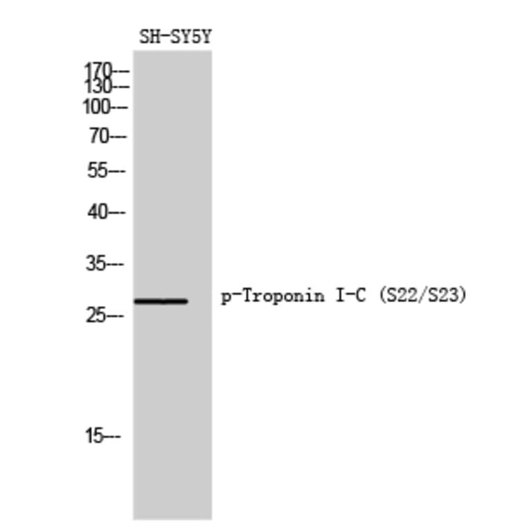 Western Blot - Anti-TNNI3 (phospho Ser22+Ser23) Antibody (A0587) - Antibodies.com