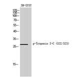 Western Blot - Anti-TNNI3 (phospho Ser22+Ser23) Antibody (A0587) - Antibodies.com