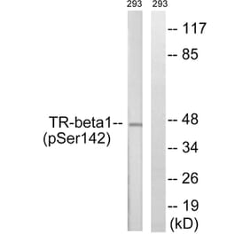 Western Blot - Anti-TR-beta1 (phospho Ser142) Antibody (A8442) - Antibodies.com